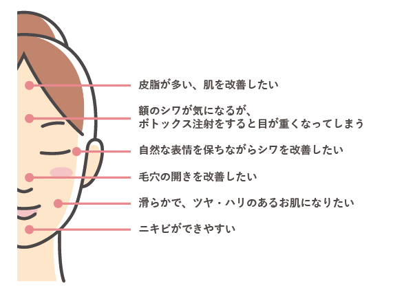 ボトックス治療（しわ・多汗症・小顔）